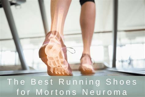 best walking shoes for morton's neuroma 2020|recommended shoes for morton's neuroma.